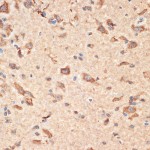 KO-Validated Bax Rabbit pAb (20 μl)