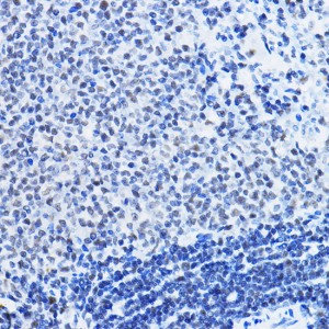 KD-Validated HDAC1 Rabbit pAb (20 μl)