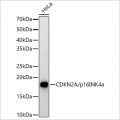 KO-Validated CDKN2A/p16INK4a Rabbit pAb (20 μl)