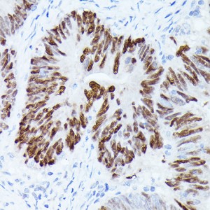 KO-Validated p53 Rabbit pAb (20 μl)