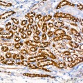 KO-Validated HK1 Rabbit mAb (20 μl)