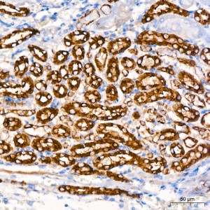 KO-Validated HK1 Rabbit mAb (20 μl)