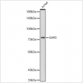 KO-Validated GARS Rabbit mAb (20 μl)