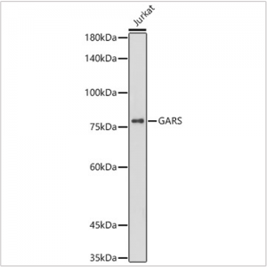 KO-Validated GARS Rabbit mAb (20 μl)
