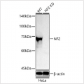 KD-Validated NF2 Rabbit pAb (20 μl)