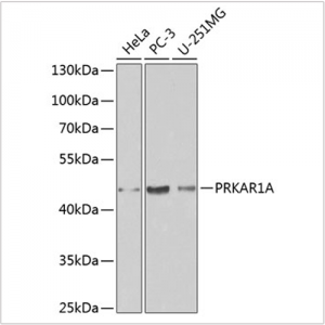 KO-Validated PRKAR1A Rabbit pAb (20 μl)