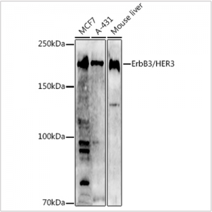 KO-Validated ErbB3/HER3 Rabbit pAb (20 μl)