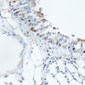 KO-Validated CDK4 Rabbit mAb (20 μl)