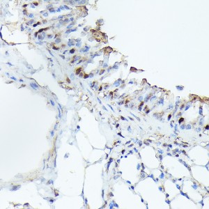 KO-Validated CDK4 Rabbit mAb (20 μl)