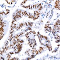 KO-Validated CDK9 Rabbit mAb (20 μl)