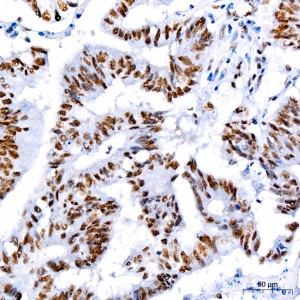 KO-Validated CDK9 Rabbit mAb (20 μl)