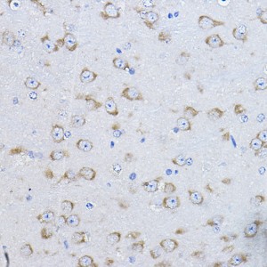 KD-Validated FAK Rabbit pAb (20 μl)