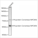 KD-Validated Proprotein Convertase 9 (PCSK9) Rabbit mAb (20 μl)