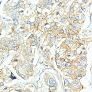 KD-Validated EGFR Rabbit pAb (20 μl)