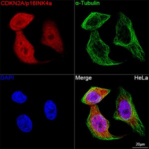 KO-Validated CDKN2A/p16INK4a Rabbit mAb (20 μl)
