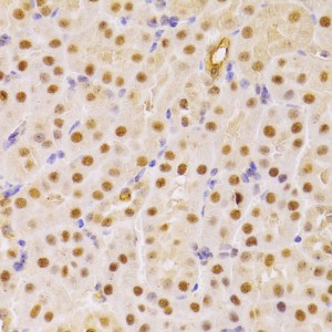 CDC25A Rabbit pAb (20 μl)