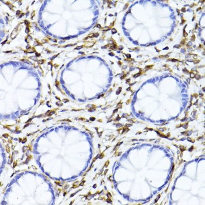 KD-Validated Vimentin Rabbit pAb (20 μl)