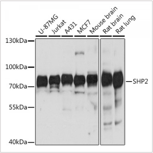 KO-Validated SHP2 Rabbit pAb (20 μl)
