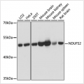 KO-Validated NDUFS2 Rabbit pAb (20 μl)