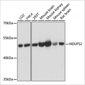 KO-Validated NDUFS2 Rabbit pAb (20 μl)