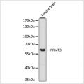 KO-Validated PRMT3 Rabbit pAb (20 μl)
