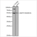 KO-Validated BAF57/SMARCE1 Rabbit pAb (20 μl)