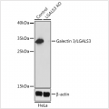 KO-Validated Galectin 3/LGALS3 Rabbit pAb (20 μl)