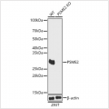 KO-Validated PSME2 Rabbit pAb (20 μl)