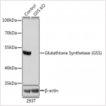 KO-Validated Glutathione Synthetase (GSS) Rabbit pAb (20 μl)