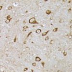 KO-Validated PHD2/EGLN1 Rabbit pAb (20 μl)