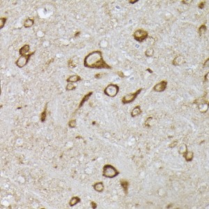 KO-Validated PHD2/EGLN1 Rabbit pAb (20 μl)