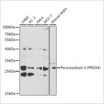 KO-Validated Peroxiredoxin 4 (PRDX4) Rabbit pAb (20 μl)