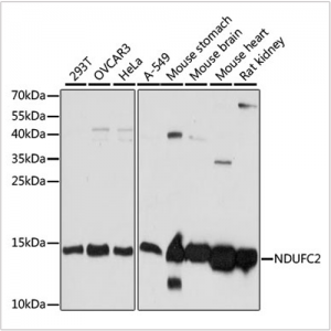 KO-Validated NDUFC2 Rabbit pAb (20 μl)