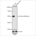 KO-Validated PKA RIIα (PRKAR2A) Rabbit pAb (20 μl)