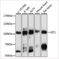 KO-Validated GIT1 Rabbit pAb (20 μl)