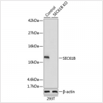 KO-Validated SEC61B Rabbit pAb (20 μl)
