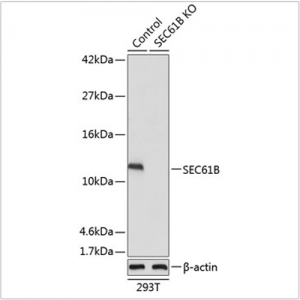 KO-Validated SEC61B Rabbit pAb (20 μl)