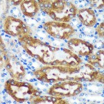 KO-Validated CHCHD2 Rabbit pAb (20 μl)