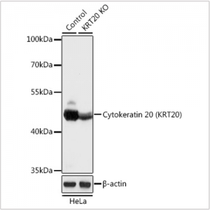 KO-Validated Cytokeratin 20 (KRT20) Rabbit pAb (20 μl)