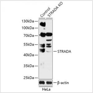 KO-Validated STRADA Rabbit pAb (20 μl)