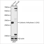 KO-Validated Carbonic Anhydrase 2 (CA2) Rabbit pAb (20 μl)