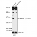 KO-Validated Galectin 1/LGALS1 Rabbit pAb (20 μl)