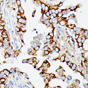 KO-Validated MAP3K1 Rabbit pAb (20 μl)