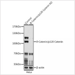 KO-Validated δ-Catenin/p120 Catenin Rabbit pAb (20 μl)