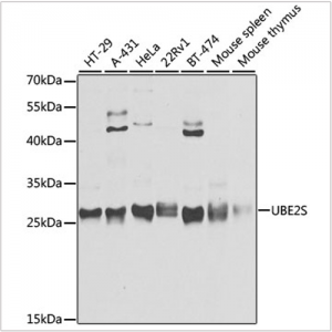KO-Validated UBE2S Rabbit pAb (20 μl)