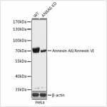 KO-Validated Annexin A6/Annexin VI Rabbit pAb (20 μl)