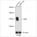 KO-Validated CBR1 Rabbit pAb (20 μl)
