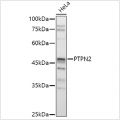 KO-Validated PTPN2 Rabbit pAb (20 μl)