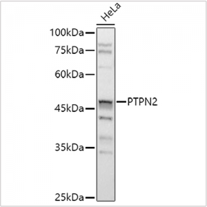 KO-Validated PTPN2 Rabbit pAb (20 μl)