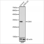 KO-Validated CDK5 Rabbit pAb (20 μl)